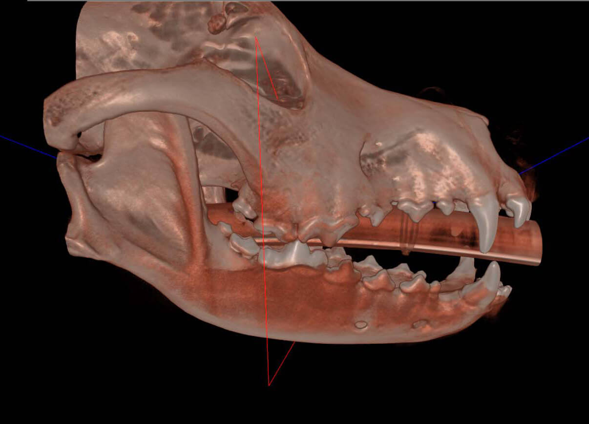 CT color dental