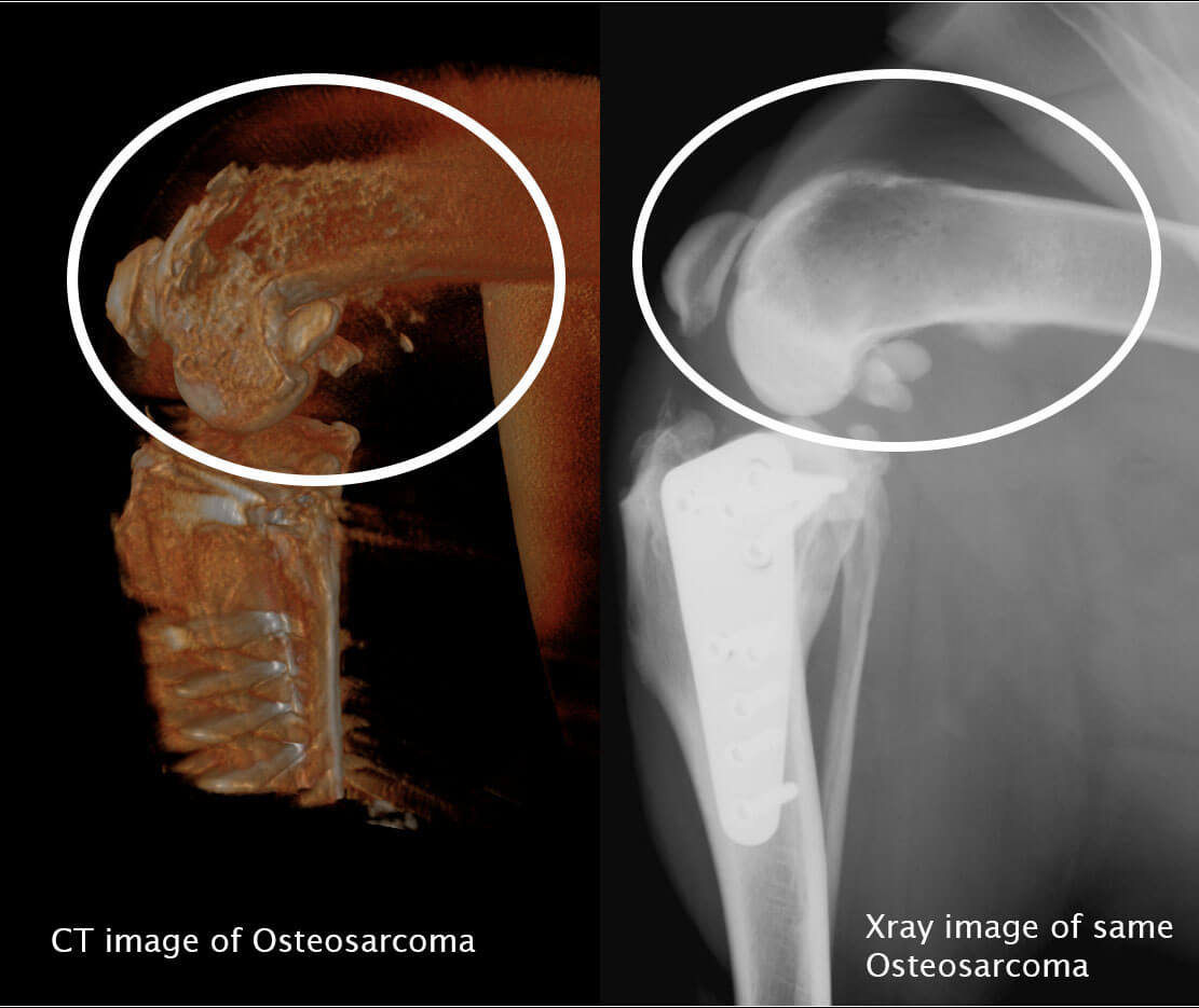 CT Osteosarcoma