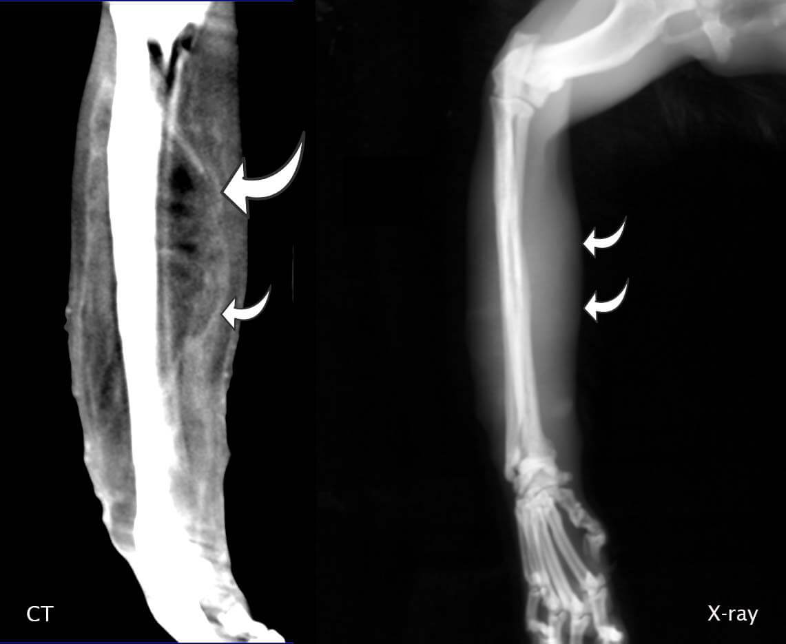 CT versus Xray