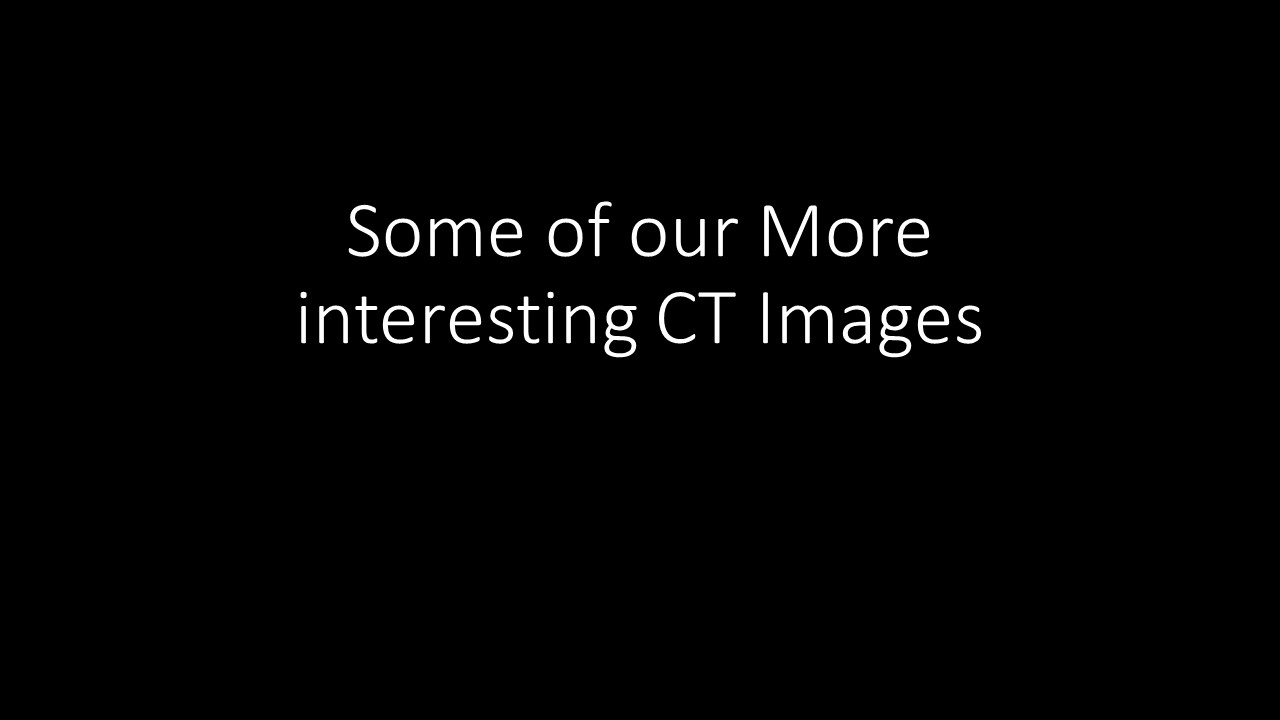 Ct Slide 1