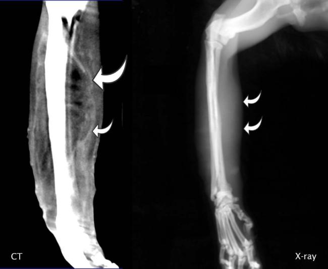 ct versus xray